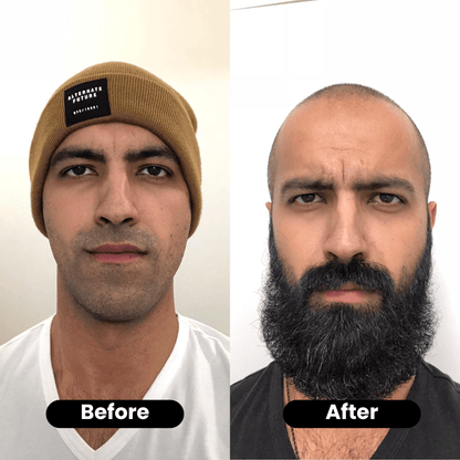 Bodywise – Hair Growth and Deep Repair Serum - Menloft