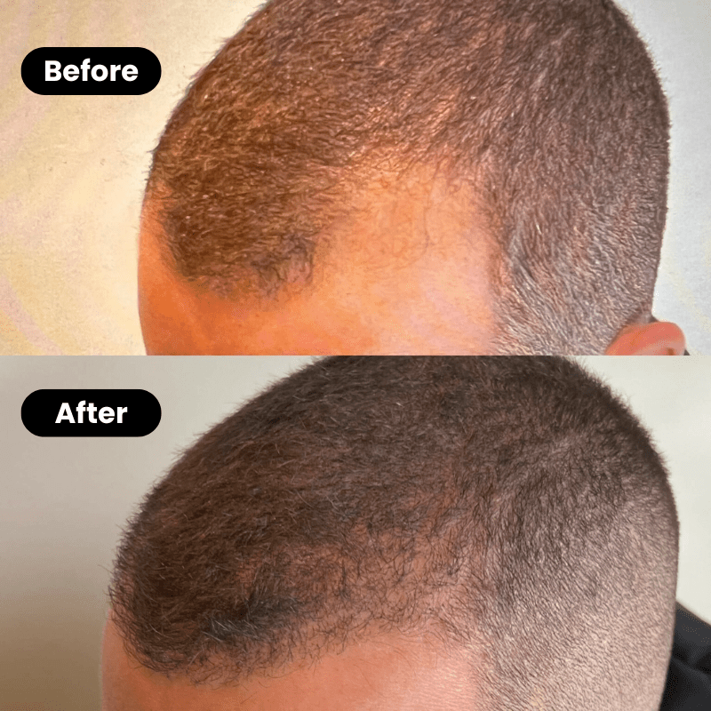 Bodywise – Hair Growth and Deep Repair Serum - Menloft