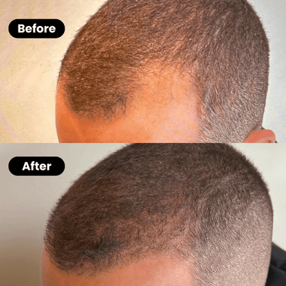 Bodywise – Hair Growth and Deep Repair Serum - Menloft