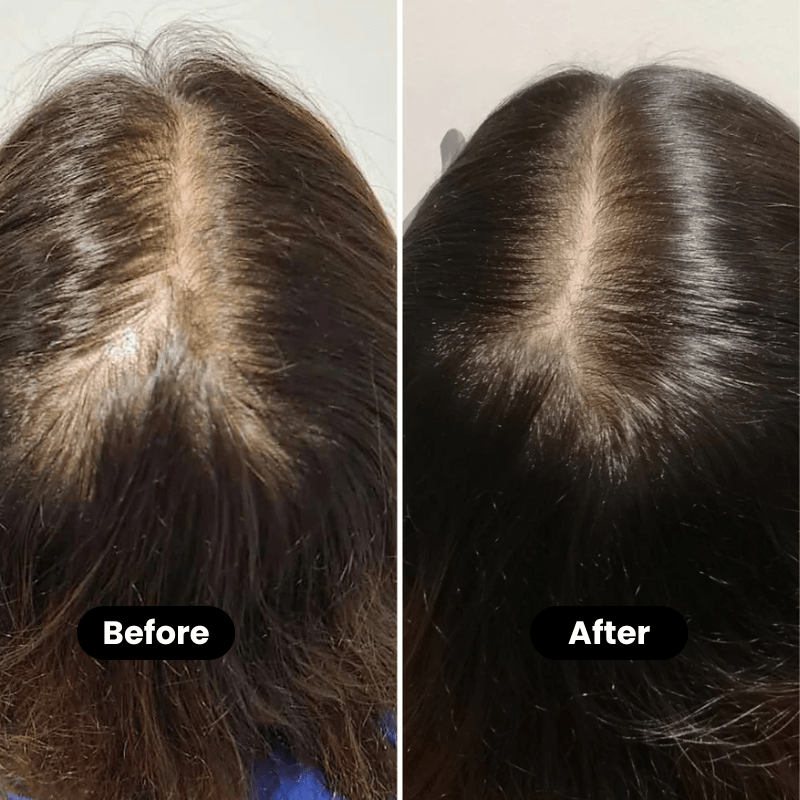 Bodywise – Hair Growth and Deep Repair Serum - Menloft