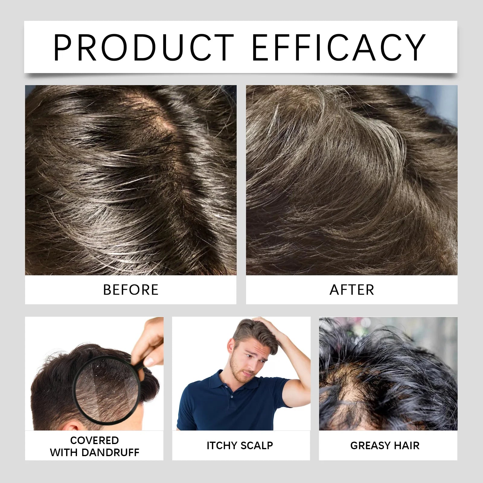 Scalp Revitalizing Shampoo - East Moon - Hydration & Shine - MENLOFT LLC