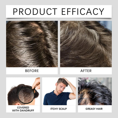 Scalp Revitalizing Shampoo - East Moon - Hydration & Shine - MENLOFT LLC