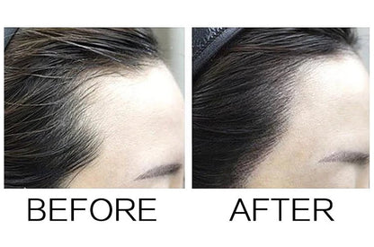 Sevich Hairline Enhancer for Men - 8 Shades of Confidence - Menloft